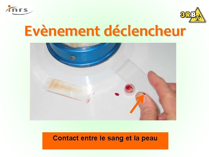 Evènement déclencheur Contact entre le sang et la peau 