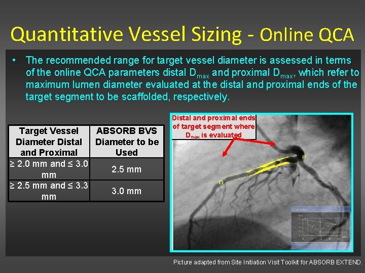 Quantitative Vessel Sizing - Online QCA • The recommended range for target vessel diameter