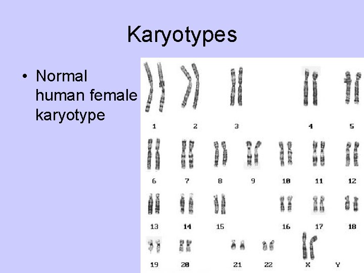 Karyotypes • Normal human female karyotype 