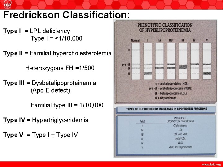 Fredrickson Classification: Type I = LPL deficiency Type I = <1/10, 000 Type II