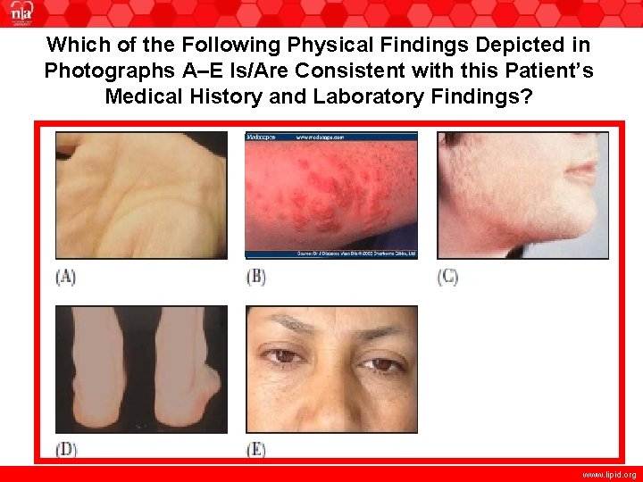Which of the Following Physical Findings Depicted in Photographs A–E Is/Are Consistent with this