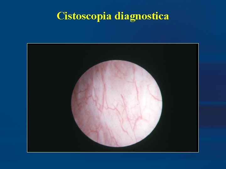 Cistoscopia diagnostica 