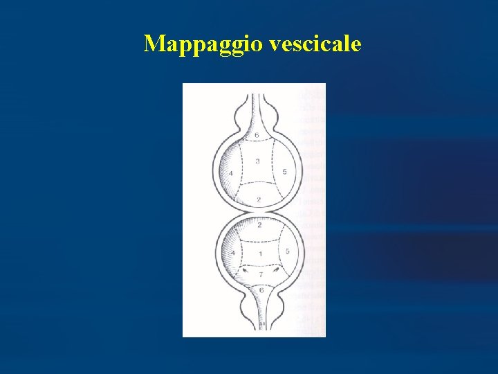 Mappaggio vescicale 