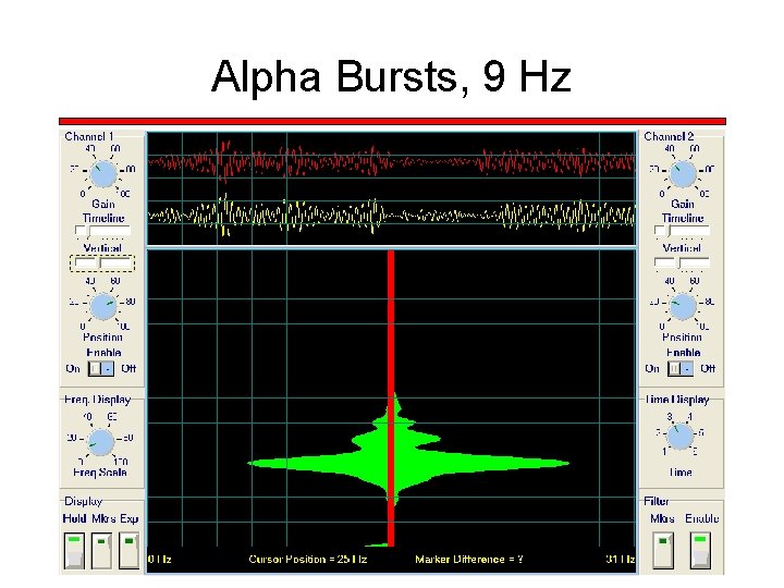 Alpha Bursts, 9 Hz 