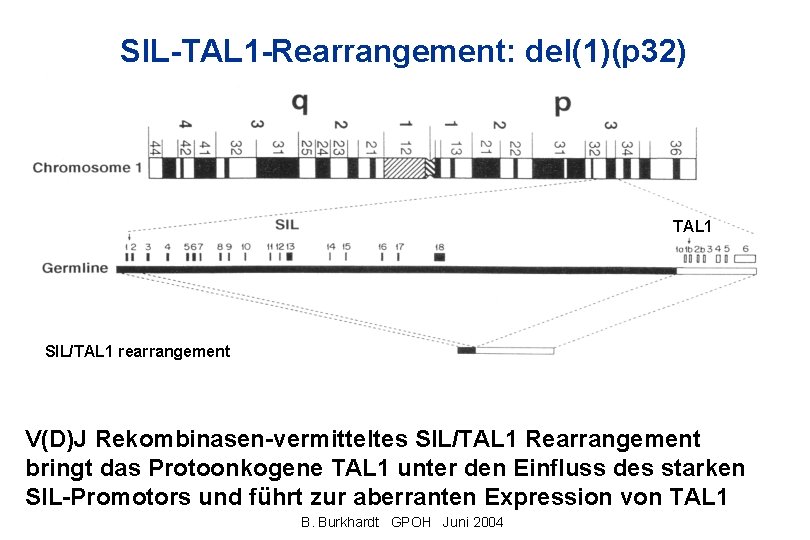 SIL-TAL 1 -Rearrangement: del(1)(p 32) TAL 1 SIL/TAL 1 rearrangement V(D)J Rekombinasen-vermitteltes SIL/TAL 1