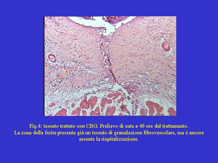 Fig. 4: tessuto trattato con CBG. Prelievo di cute a 48 ore dal trattamento.