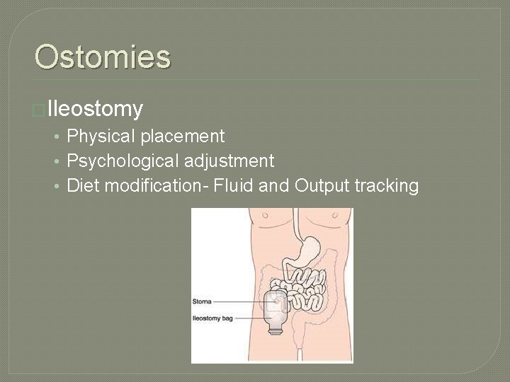 Ostomies �Ileostomy • Physical placement • Psychological adjustment • Diet modification- Fluid and Output