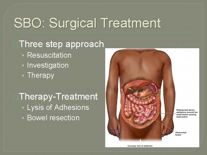 SBO: Surgical Treatment �Three step approach • Resuscitation • Investigation • Therapy �Therapy-Treatment •