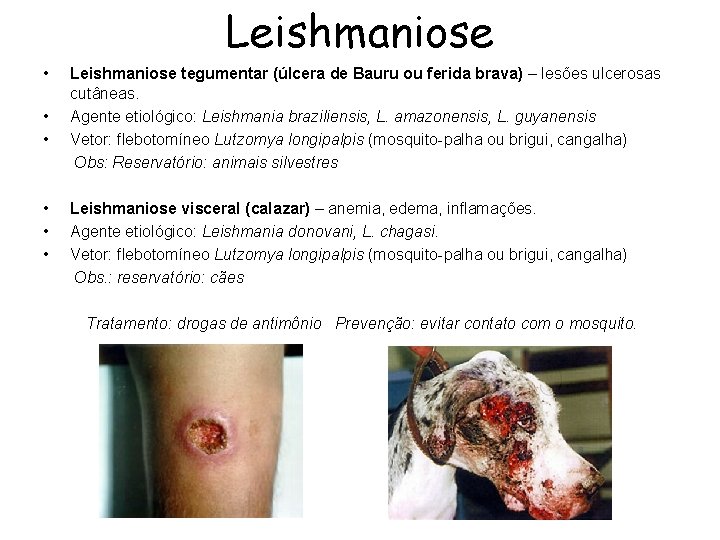 Leishmaniose • • • Leishmaniose tegumentar (úlcera de Bauru ou ferida brava) – lesões