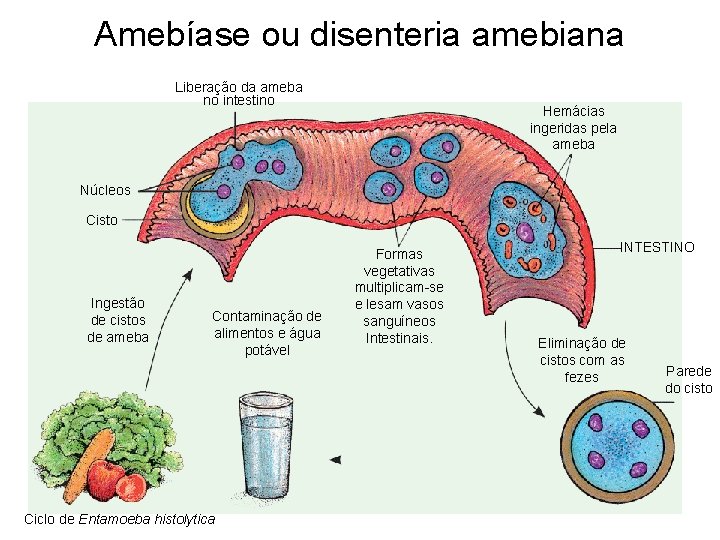 Amebíase ou disenteria amebiana Liberação da ameba no intestino Hemácias ingeridas pela ameba Núcleos