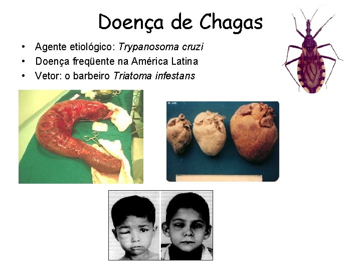 Doença de Chagas • Agente etiológico: Trypanosoma cruzi • Doença freqüente na América Latina