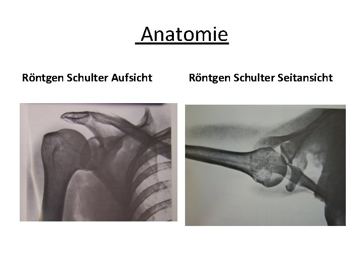 Anatomie Röntgen Schulter Aufsicht Röntgen Schulter Seitansicht 