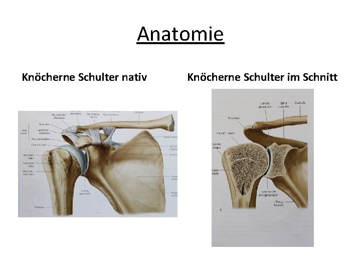 Anatomie Knöcherne Schulter nativ Knöcherne Schulter im Schnitt 