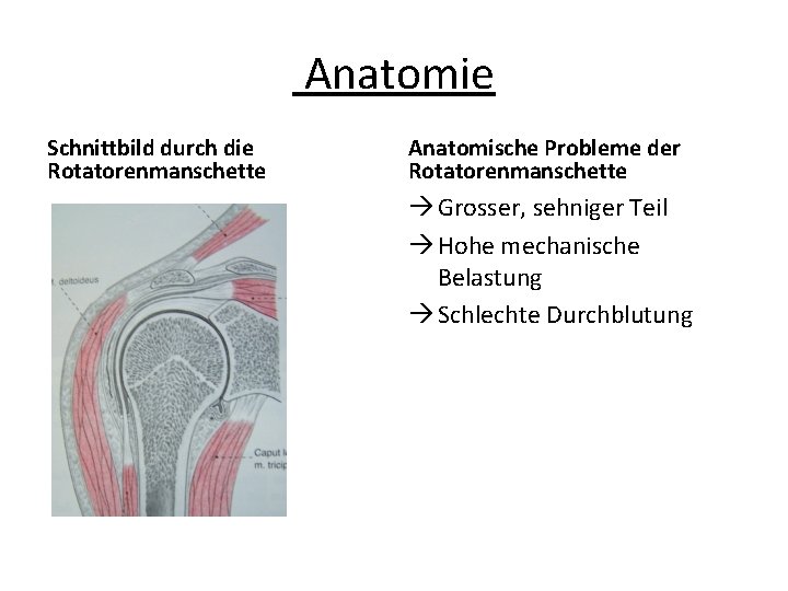 Anatomie Schnittbild durch die Rotatorenmanschette Anatomische Probleme der Rotatorenmanschette Grosser, sehniger Teil Hohe mechanische