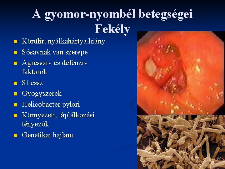 A gyomor-nyombél betegségei Fekély n n n n Körülírt nyálkahártya hiány Sósavnak van szerepe A gyomor-nyombél betegségei Fekély n n n n Körülírt nyálkahártya hiány Sósavnak van szerepe
