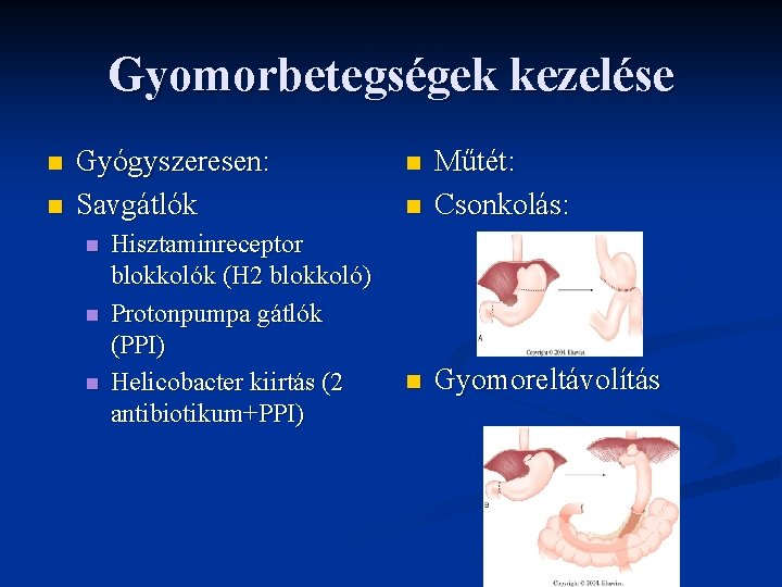 Gyomorbetegségek kezelése n n Gyógyszeresen: Savgátlók n n n Hisztaminreceptor blokkolók (H 2 blokkoló)