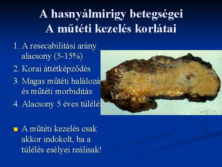 A hasnyálmirigy betegségei A műtéti kezelés korlátai 1. A resecabilitási arány alacsony (5 -15%) A hasnyálmirigy betegségei A műtéti kezelés korlátai 1. A resecabilitási arány alacsony (5 -15%)