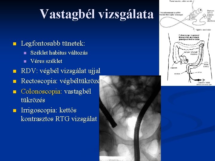 Vastagbél vizsgálata n Legfontosabb tünetek: n n n Széklet habitus változás Véres széklet RDV: