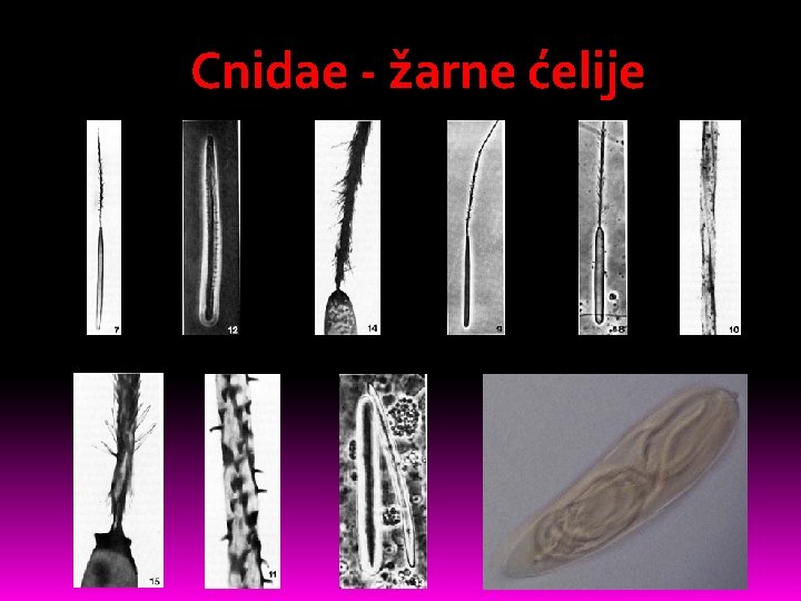 Cnidae - žarne ćelije 