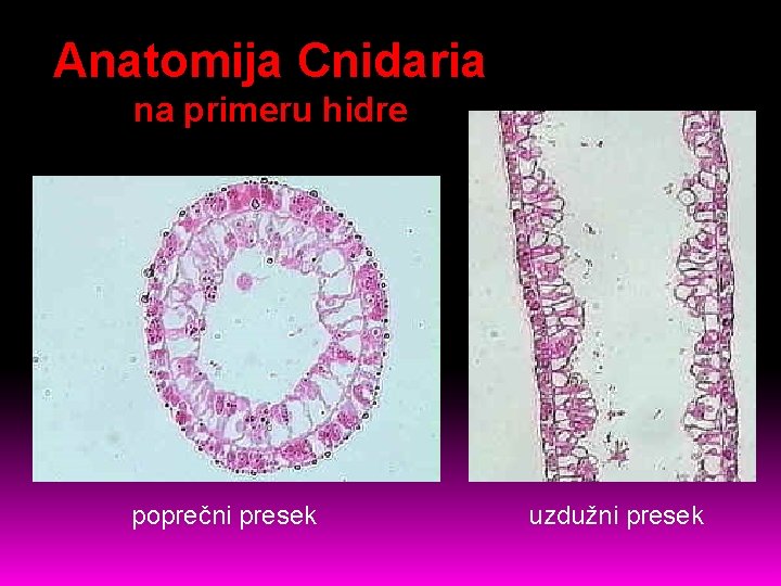 Anatomija Cnidaria na primeru hidre poprečni presek uzdužni presek 