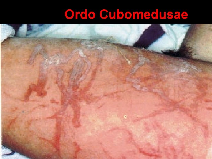 Ordo Cubomedusae 