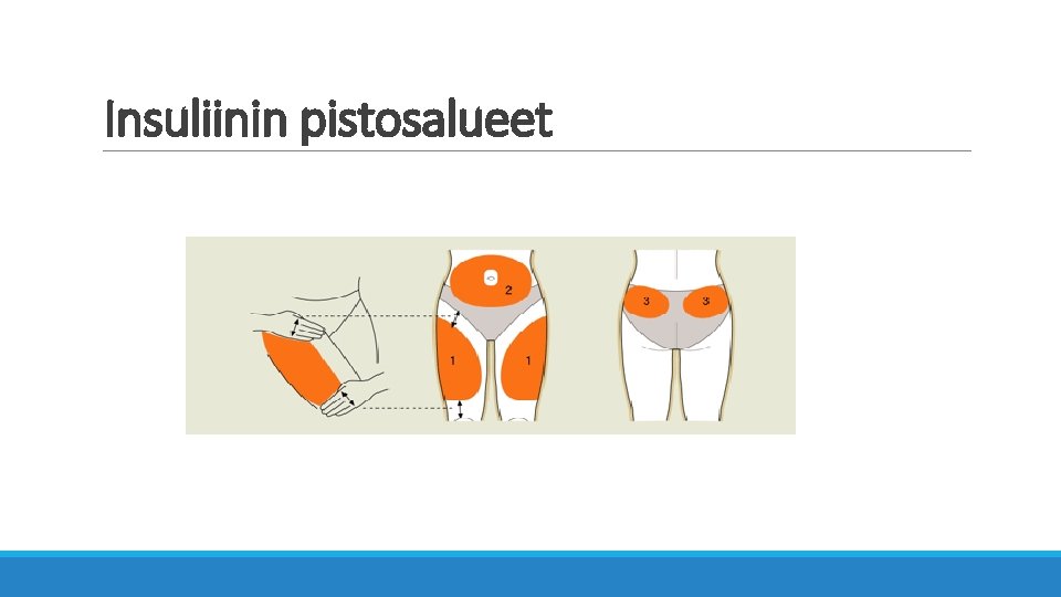 Insuliinin pistosalueet 