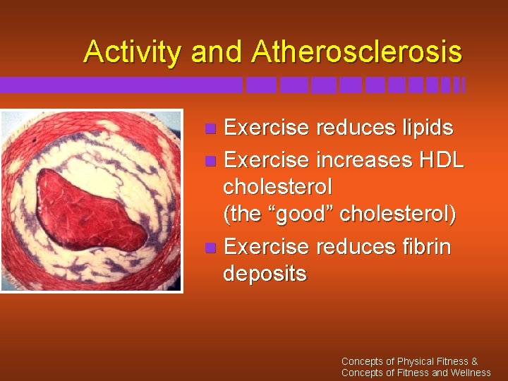 Activity and Atherosclerosis Exercise reduces lipids n Exercise increases HDL cholesterol (the “good” cholesterol)