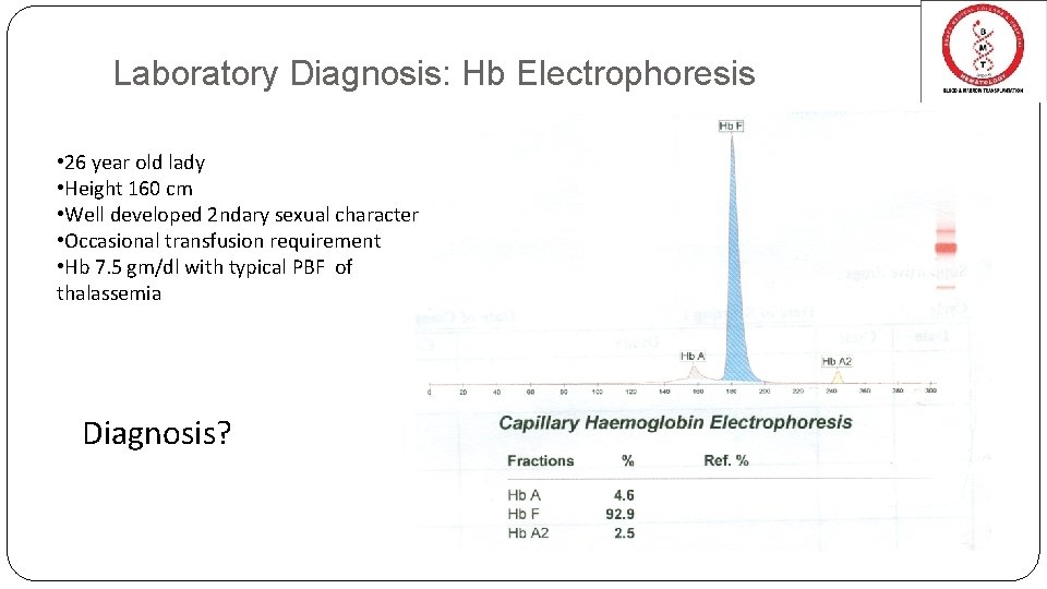 Laboratory Diagnosis: Hb Electrophoresis • 26 year old lady • Height 160 cm •