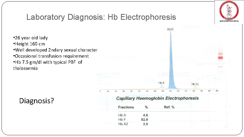 Laboratory Diagnosis: Hb Electrophoresis • 26 year old lady • Height 160 cm • Laboratory Diagnosis: Hb Electrophoresis • 26 year old lady • Height 160 cm •