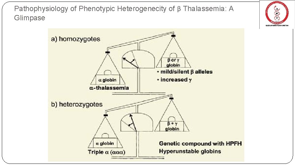 Pathophysiology of Phenotypic Heterogenecity of β Thalassemia: A Glimpase 