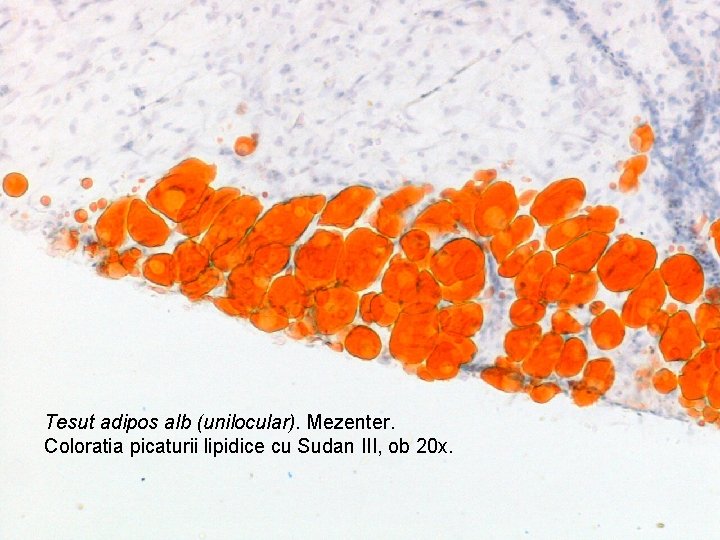 Tesut adipos alb (unilocular). Mezenter. Coloratia picaturii lipidice cu Sudan III, ob 20 x.