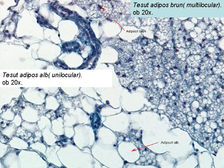 Tesut adipos brun( multilocular). ob 20 x. Tesut adipos alb( unilocular). ob 20 x.