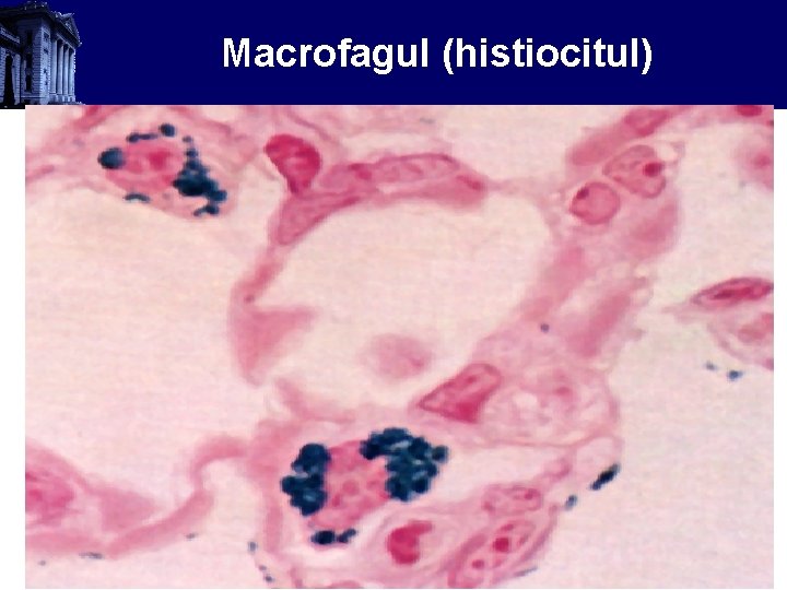 Macrofagul (histiocitul) 