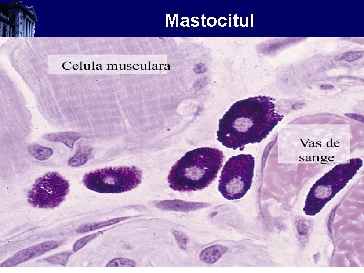 Mastocitul 