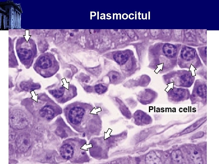 Plasmocitul 