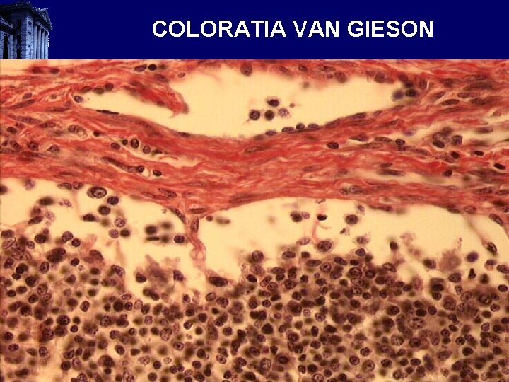 COLORATIA VAN GIESON 