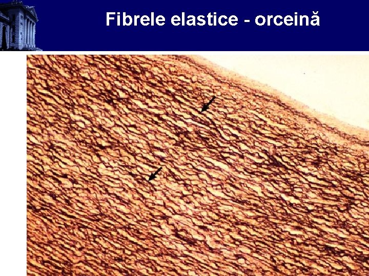 Fibrele elastice - orceină 