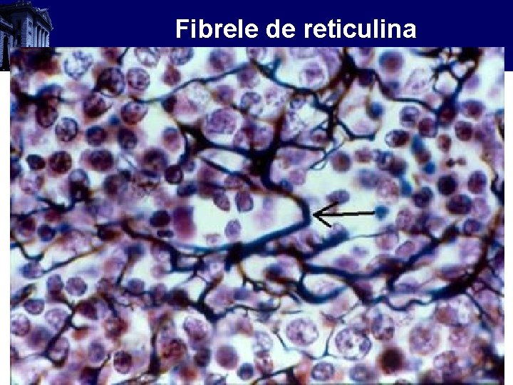 Fibrele de reticulina 