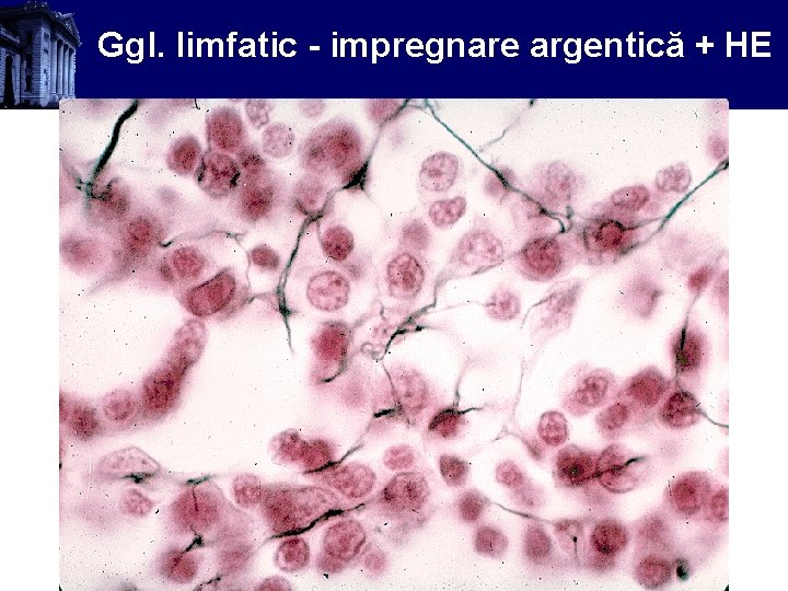 Ggl. limfatic - impregnare argentică + HE 