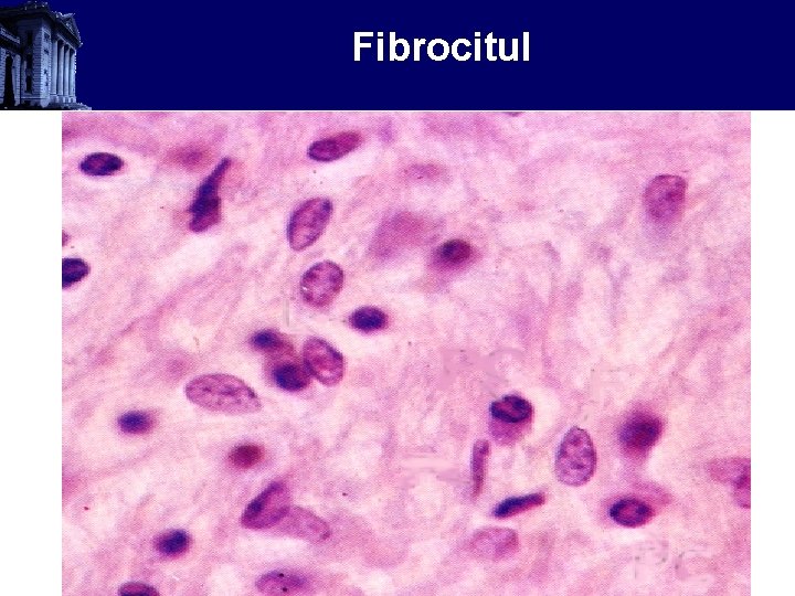 Fibrocitul 
