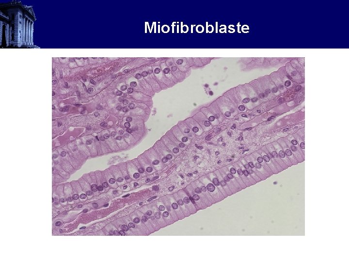 Miofibroblaste 