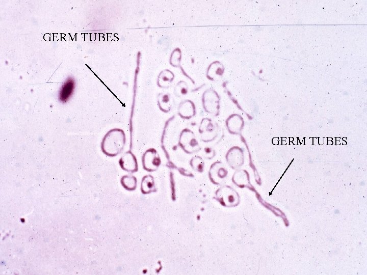 GERM TUBES 