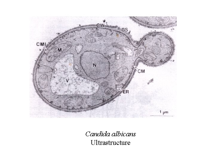 Candida albicans Ultrastructure 