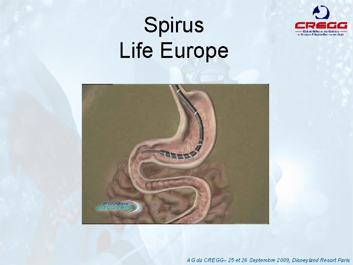 Spirus Life Europe AG du CREGG– 25 et 26 Septembre 2009, Disneyland Resort Paris