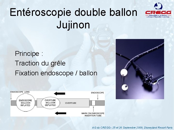 Entéroscopie double ballon Jujinon Principe : Traction du grêle Fixation endoscope / ballon AG