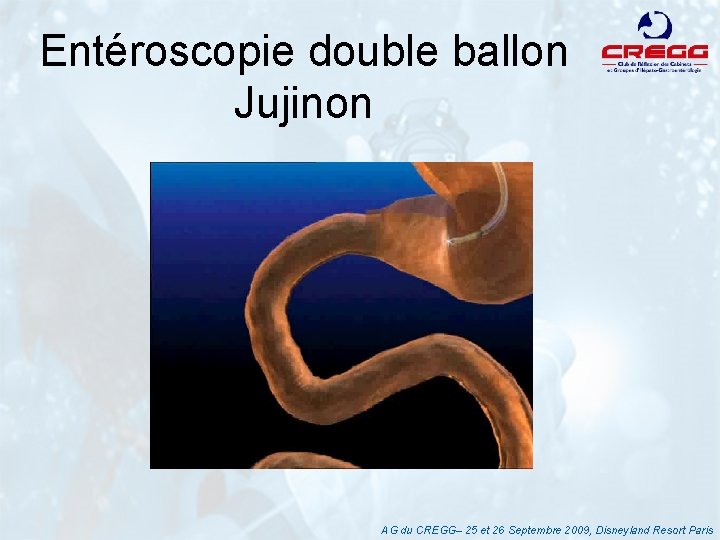 Entéroscopie double ballon Jujinon AG du CREGG– 25 et 26 Septembre 2009, Disneyland Resort