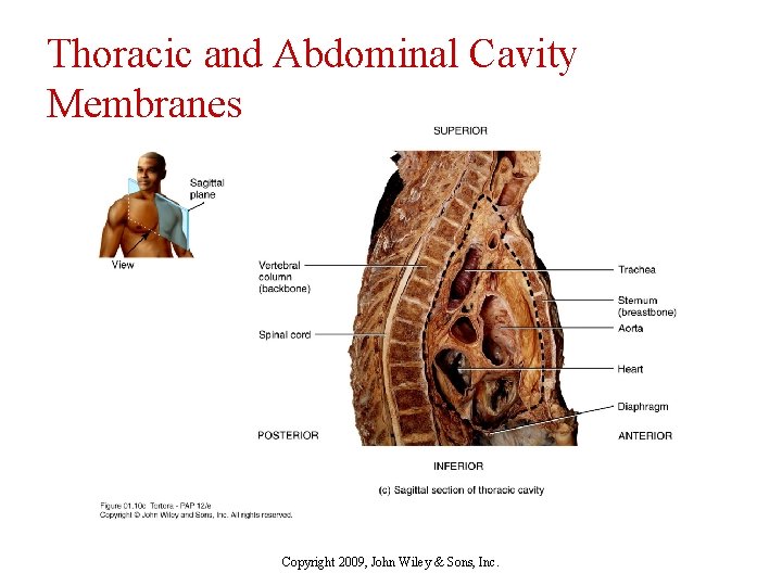 Thoracic and Abdominal Cavity Membranes Copyright 2009, John Wiley & Sons, Inc. 