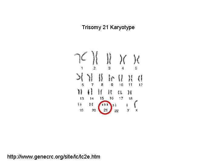 Trisomy 21 Karyotype http: //www. genecrc. org/site/lc/lc 2 e. htm 