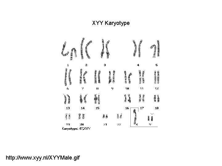 XYY Karyotype http: //www. xyy. nl/XYYMale. gif 