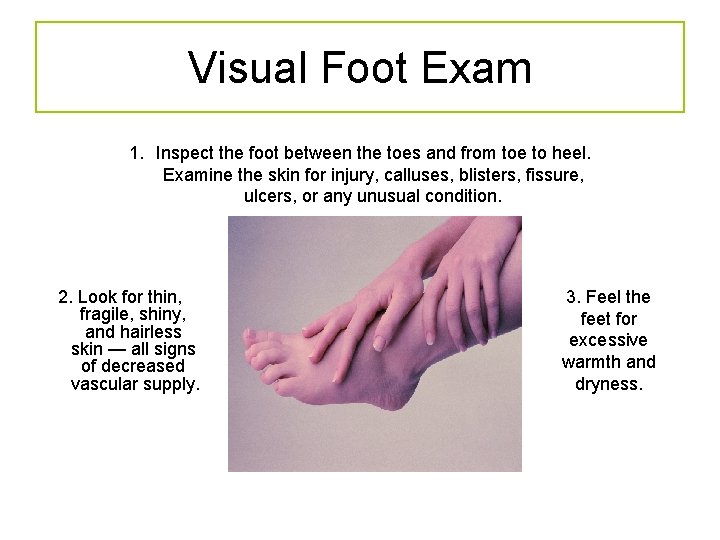 Visual Foot Exam 1. Inspect the foot between the toes and from toe to